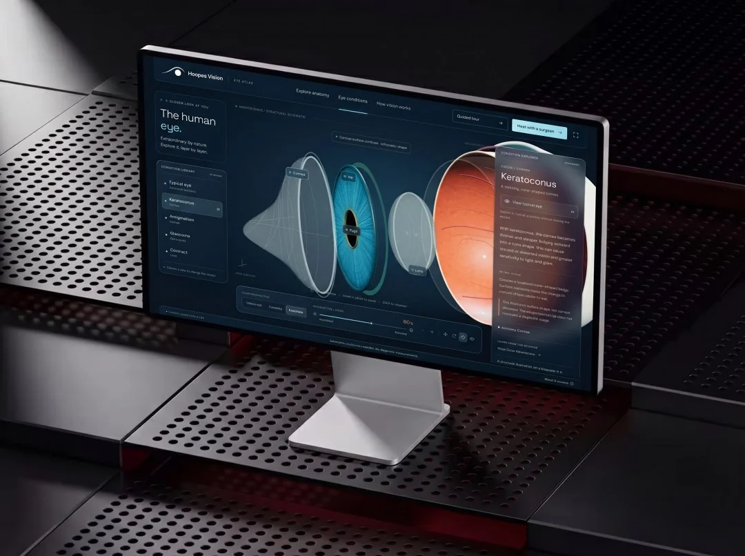 Desktop monitor mockup showing Hoopes Vision Atlas with separated eye structures and a condition information panel.